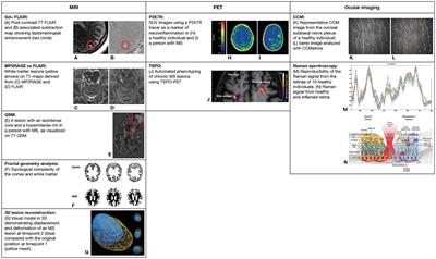 Neuroimaging to monitor worsening of multiple sclerosis: advances supported by the grant for multiple sclerosis innovation